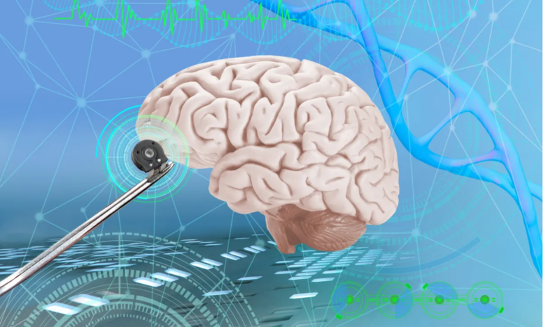 Implante cerebral con IA permite a paciente sin habla comunicarse en 2 idiomas