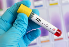 Nuevos avances en la vacuna contra el VIH gracias a una estrategia secuencial Nuevos avances en la vacuna contra el VIH gracias a una estrategia secuencial